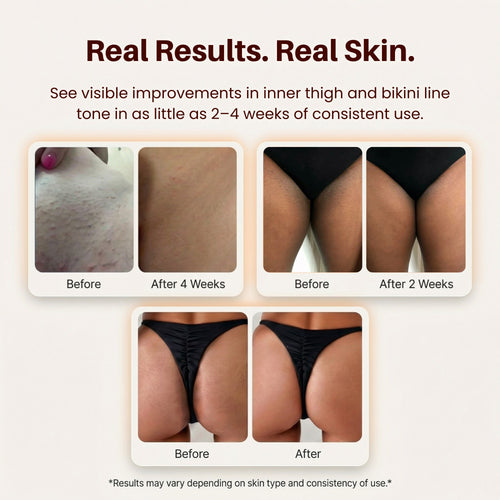 Even Tone Pads – For Intimate Areas